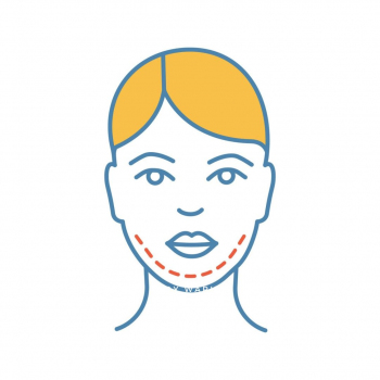 Natchaya Clinic - Chin Implant 