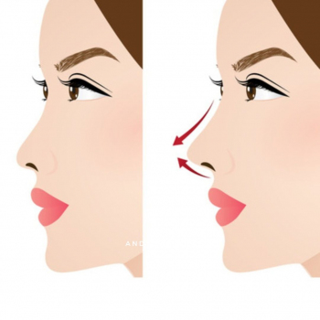 TravelMEDI - Nose Reduction 