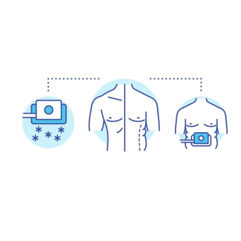 VARIS clinic - Lipolysis (fat reduction) 
