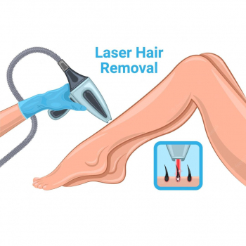 Estebox Istanbul - Laser Hair Removal: Whole Legs 