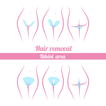 De-Klinika - Laser Hair Removal: Bikini Line 
