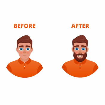 Colic Hospital - Beard Transplant 