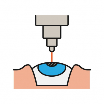 My Esthetics Turkey - Laser Eye Surgery 