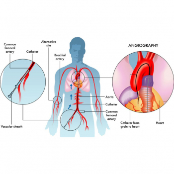 Cosmetocity - dr. Duygu Aksoy - Koronarna angiografija 