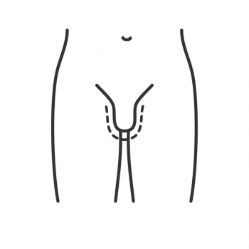 Medipunto Clinic - Male Breast Reduction (Gynaecomastia) 