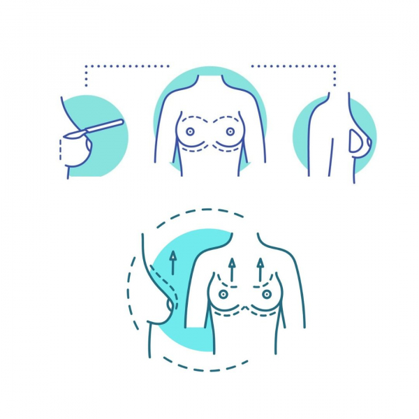 Reyap Hospital - Breast Lift and Augmentation 