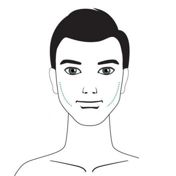 Hermes Clinics - Malarplastika 