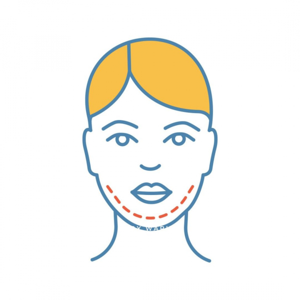 Mea Clinic - Chin Implant 