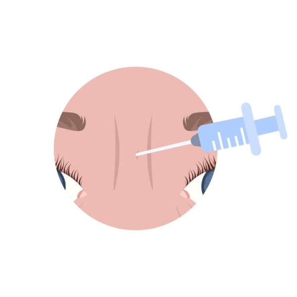 Nobilis - Botox-Frown Line 