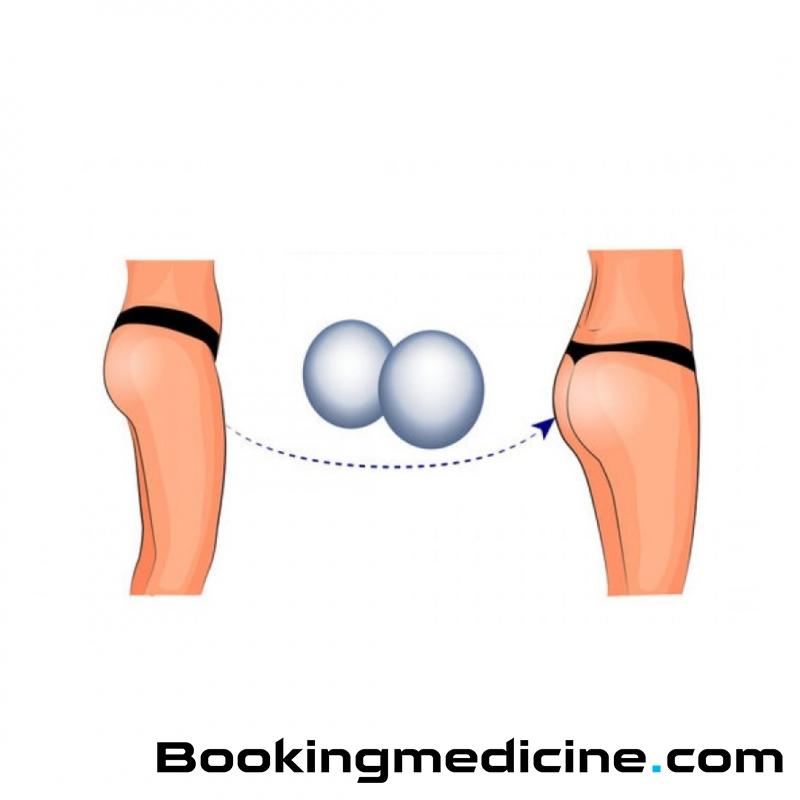 Colic Hospital - Buttocks Augmentation (Implant) 