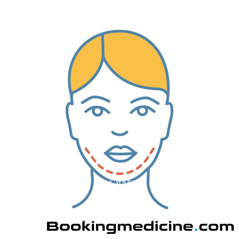 Absolute Beauty Clinic - Implantat za bradu 