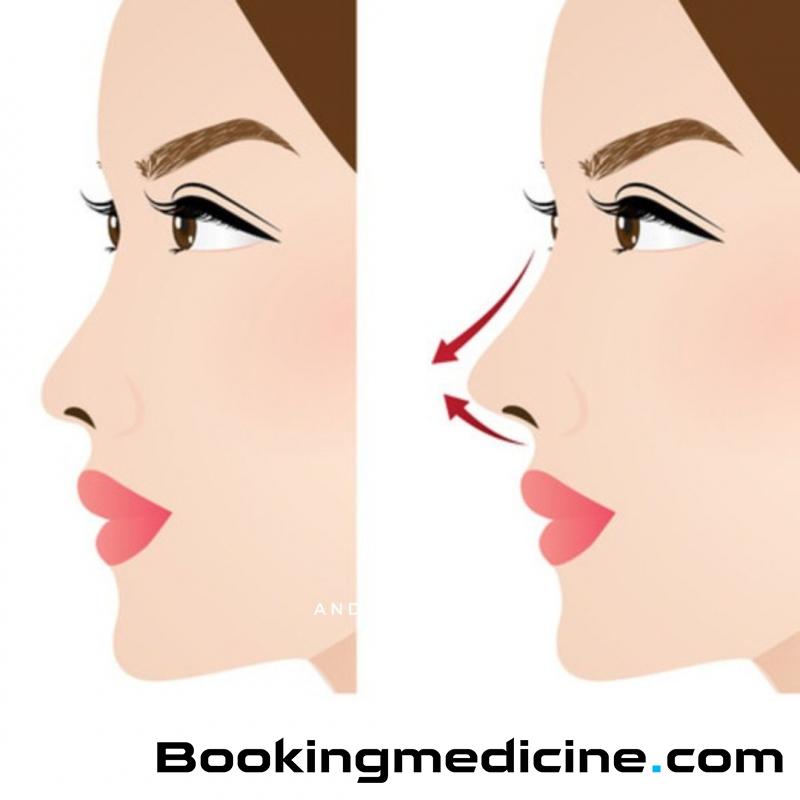 Cosmetocity - dr. Duygu Aksoy - Nose Reduction 