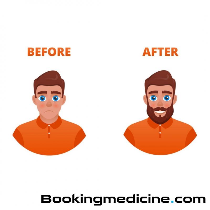 Cosmetocity - dr. Mert Cokyasar - Beard Transplant 