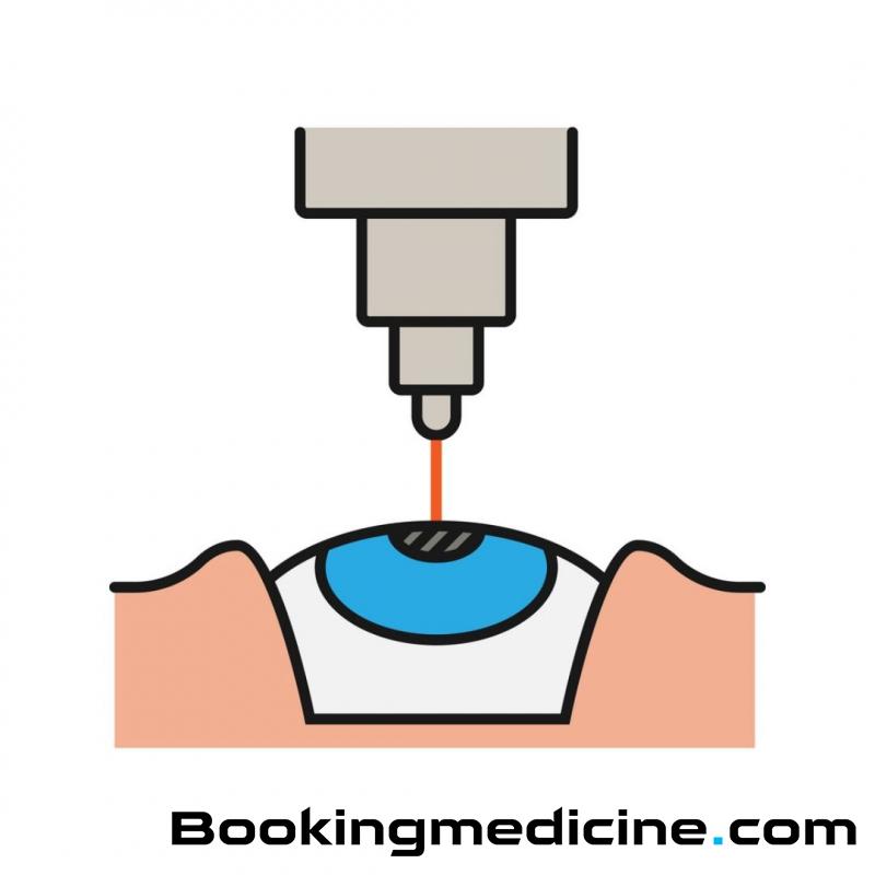 EsteBoss - Laser Eye Surgery 