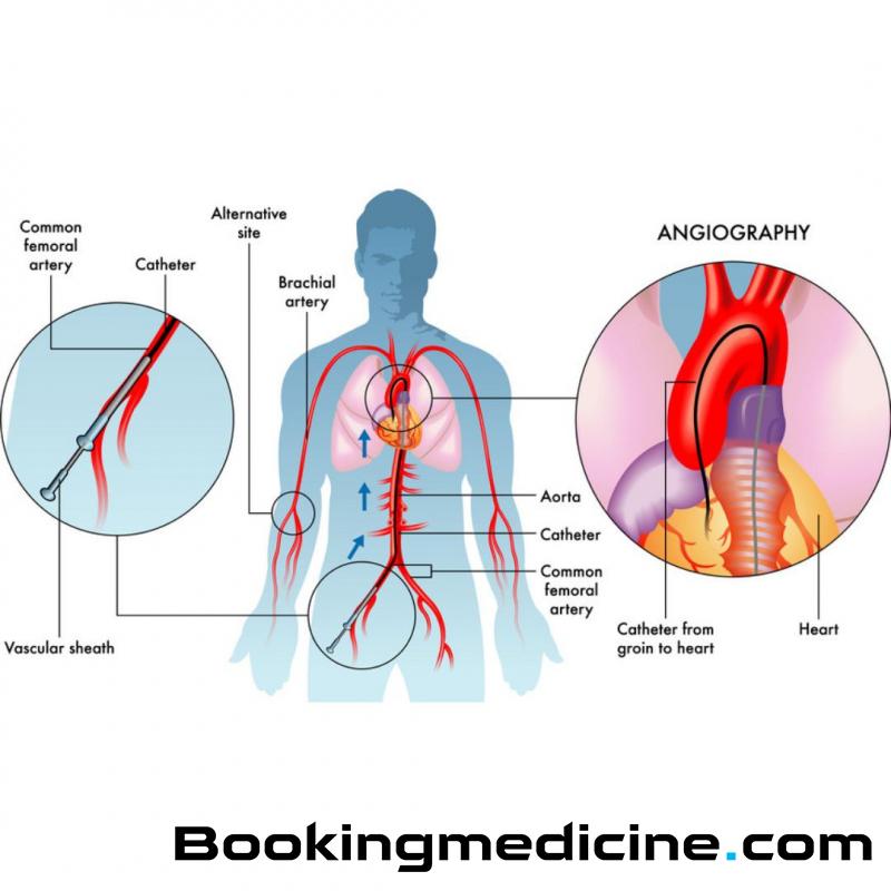 Cosmetocity - dr. Duygu Aksoy - Koronarna angiografija 